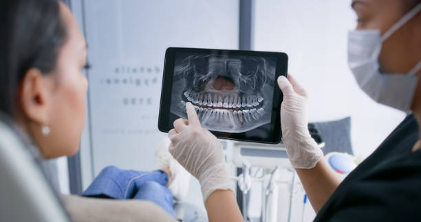 Licensed Dental Implants service in Upland, CA - Smile Center Dentistry