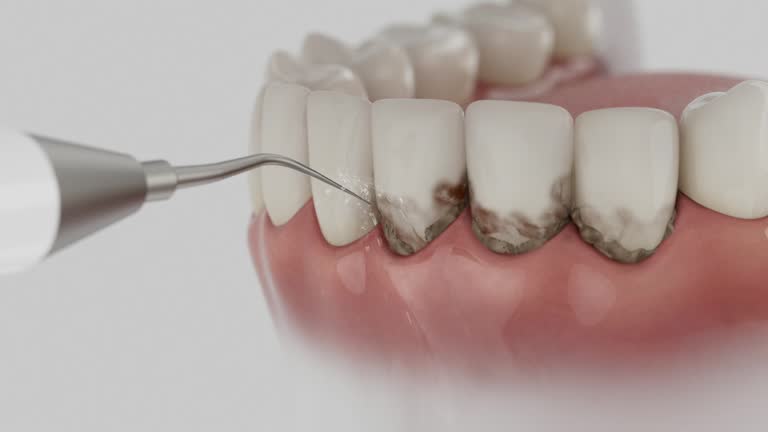 Reliable Dental Implants contractor in Upland, CA by Smile Center Dentistry